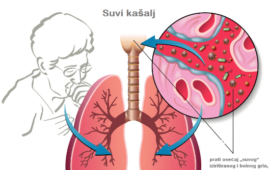 prirodni lek za kasalj