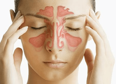 prirodno lecenje upale sinusa