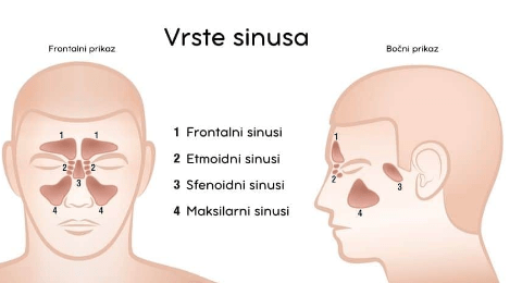 prirodno lecenje upale sinusa